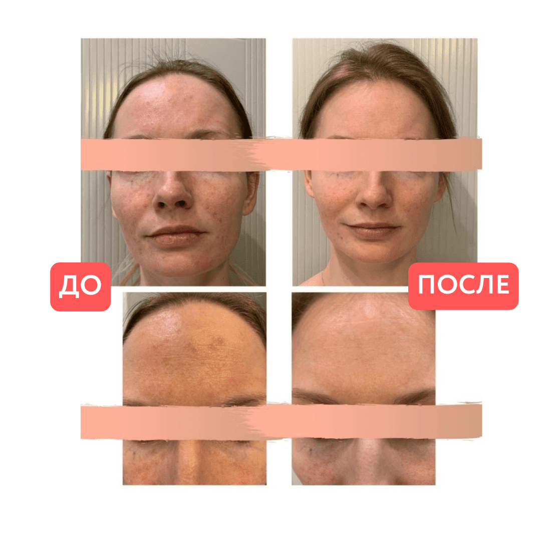 93-png.54621